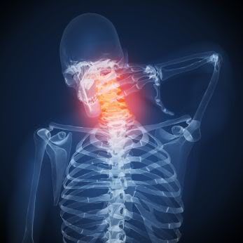 X-ray if a person rubbing their sore neck.